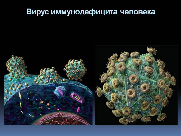 Иммунодефицит это вич. Вирус иммунодефицита. ВИЧ вирус иммунодефицита человека. Вирус СПИДА В разрезе. Как выглядит вирус ВИЧ.